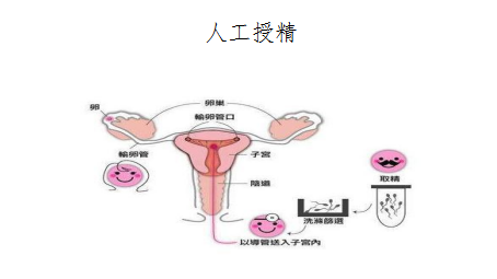 【生殖科普】“人工授精”与“试管婴儿”有什么不同？