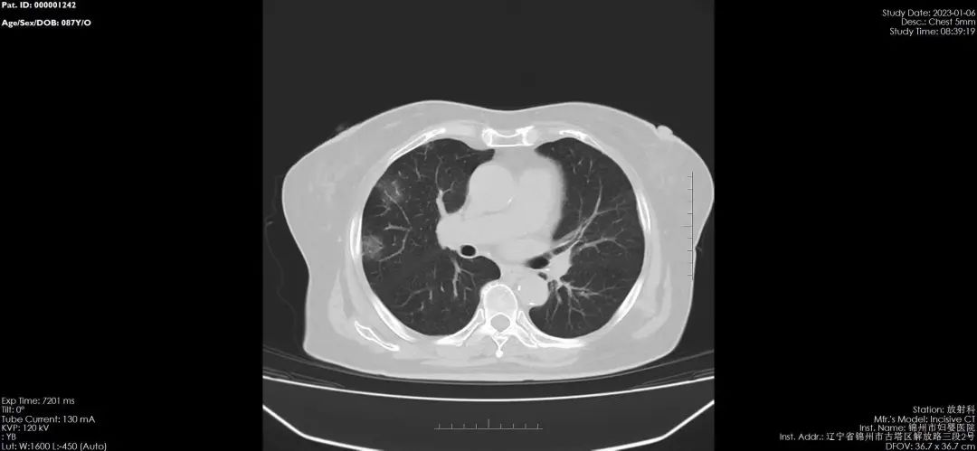 【医疗时讯】锦州市妇婴医院（妇幼保健院）24小时接诊肺部CT检查