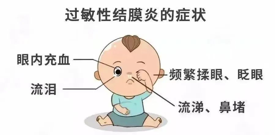 【健康科普】春季孩子眼睛过敏怎么办？