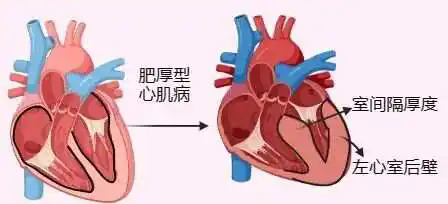 【健康科普】是什么导致小小的你如此痛苦