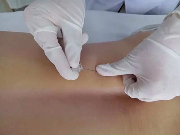 【中医科普】中医减肥效果好