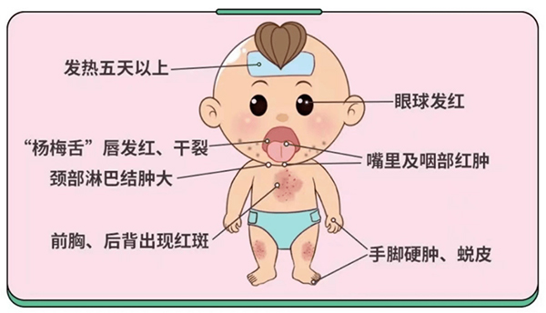 【健康科普】家长要警惕：连续发烧不一定是感冒！