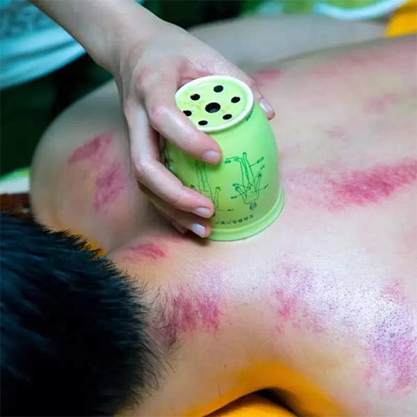 【中医科普】雨水润万物，中医护安康——二十四节气养生保健之雨水