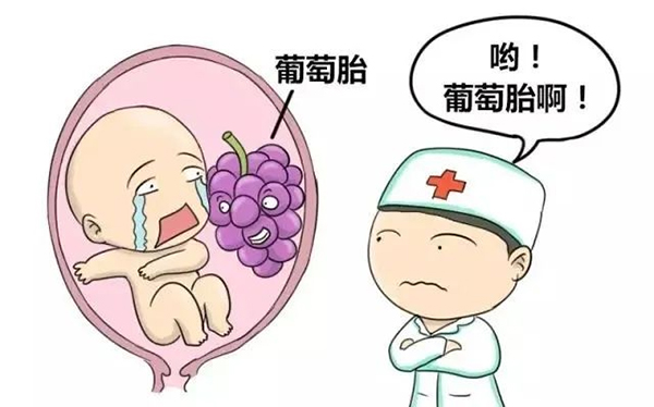 【健康科普】葡萄胎：一种特殊的异常怀孕