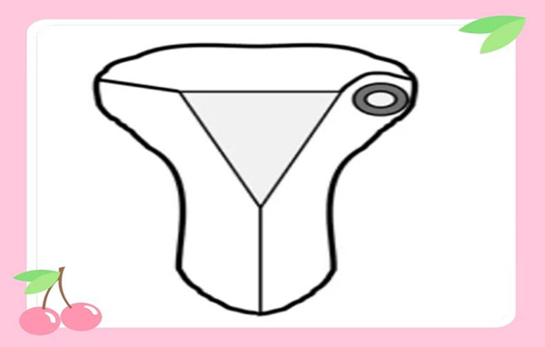 【健康科普】肌壁间妊娠：一种罕见的“危险妊娠”