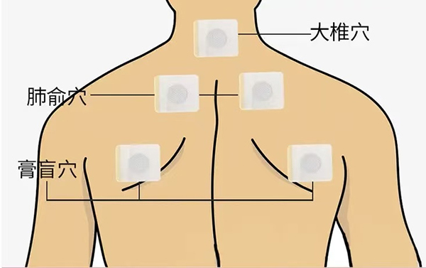 【中医科普】炎极守阳日，养生正当时——二十四节气养生保健之大暑