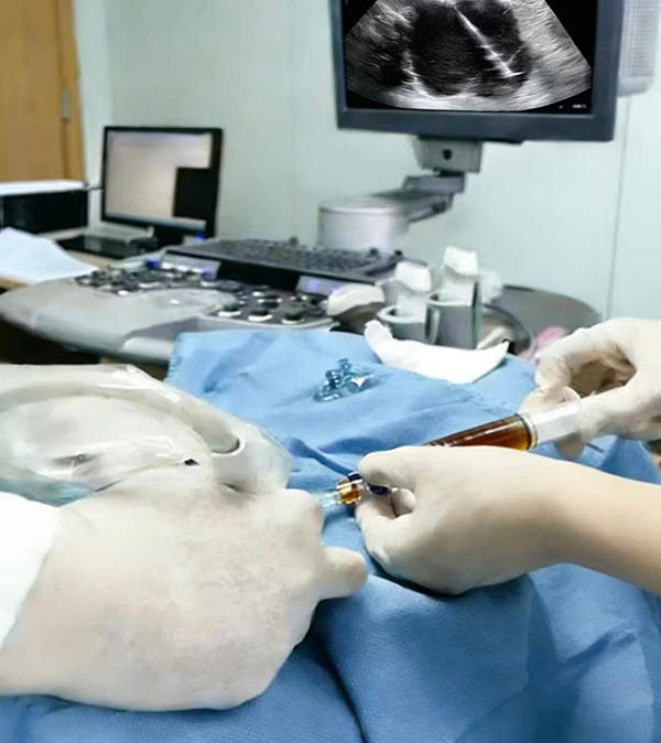 【优势技术】精准“探”病，微创“解”忧！我院超声科这些“黑科技”太省心了