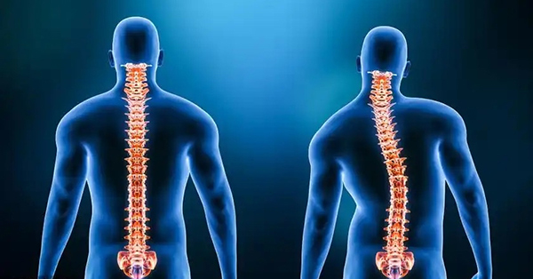 【中医科普】冬至到，寒彻骨！给你的脊柱点一把“暖身火”